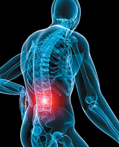 low_backpain 6-24-15